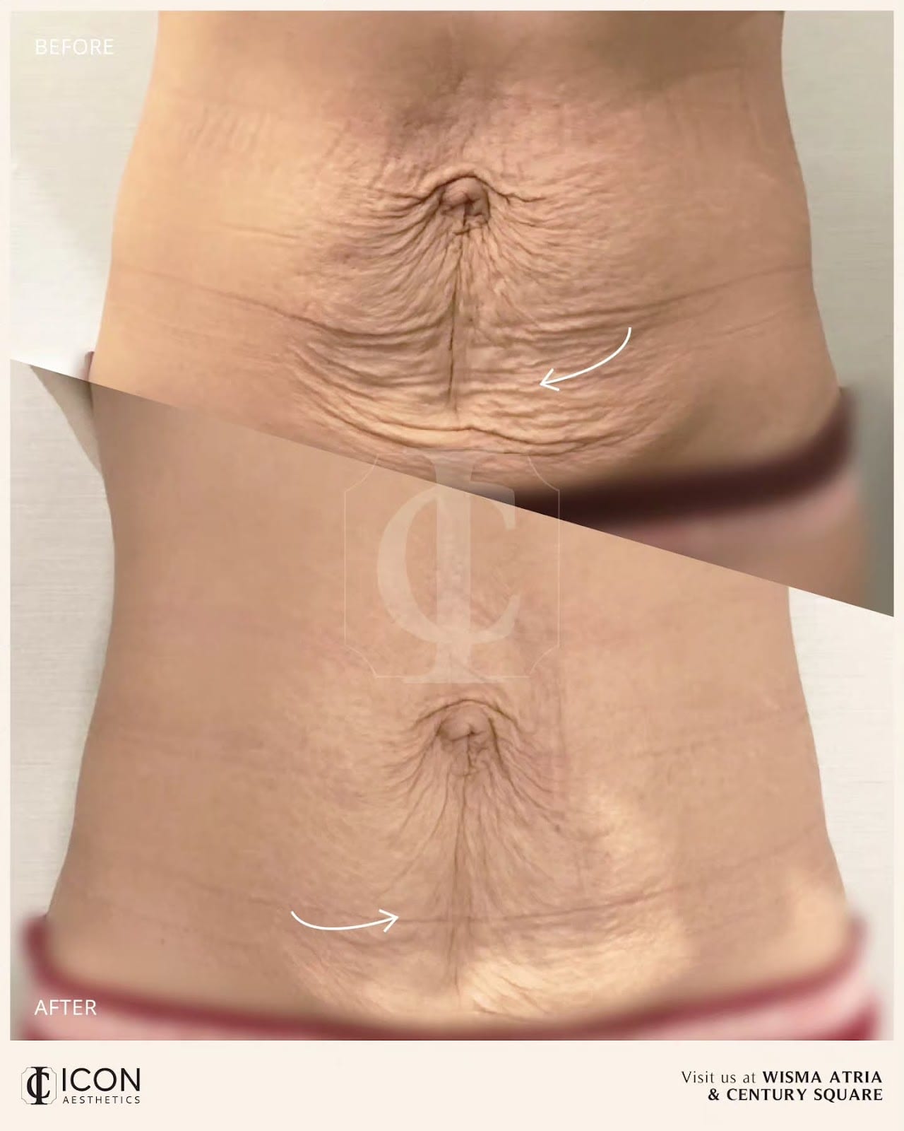 Clinical assessment and skin transformation review with client at ICON Aesthetics